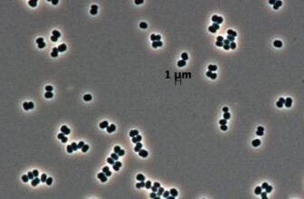 This Microbe ‘Performs Useless’ in NASA Clear Rooms, and We Might Have Despatched It to Mars